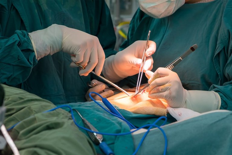 General Surgery