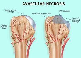 General Surgery